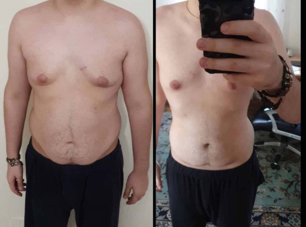 Client bărbat înainte și după, abdomen mai plat