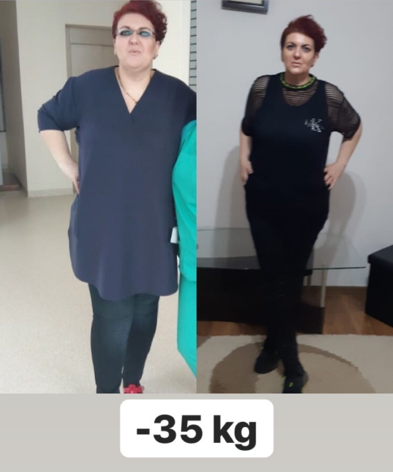 Clientă înainte și după, minus 35 de kilograme